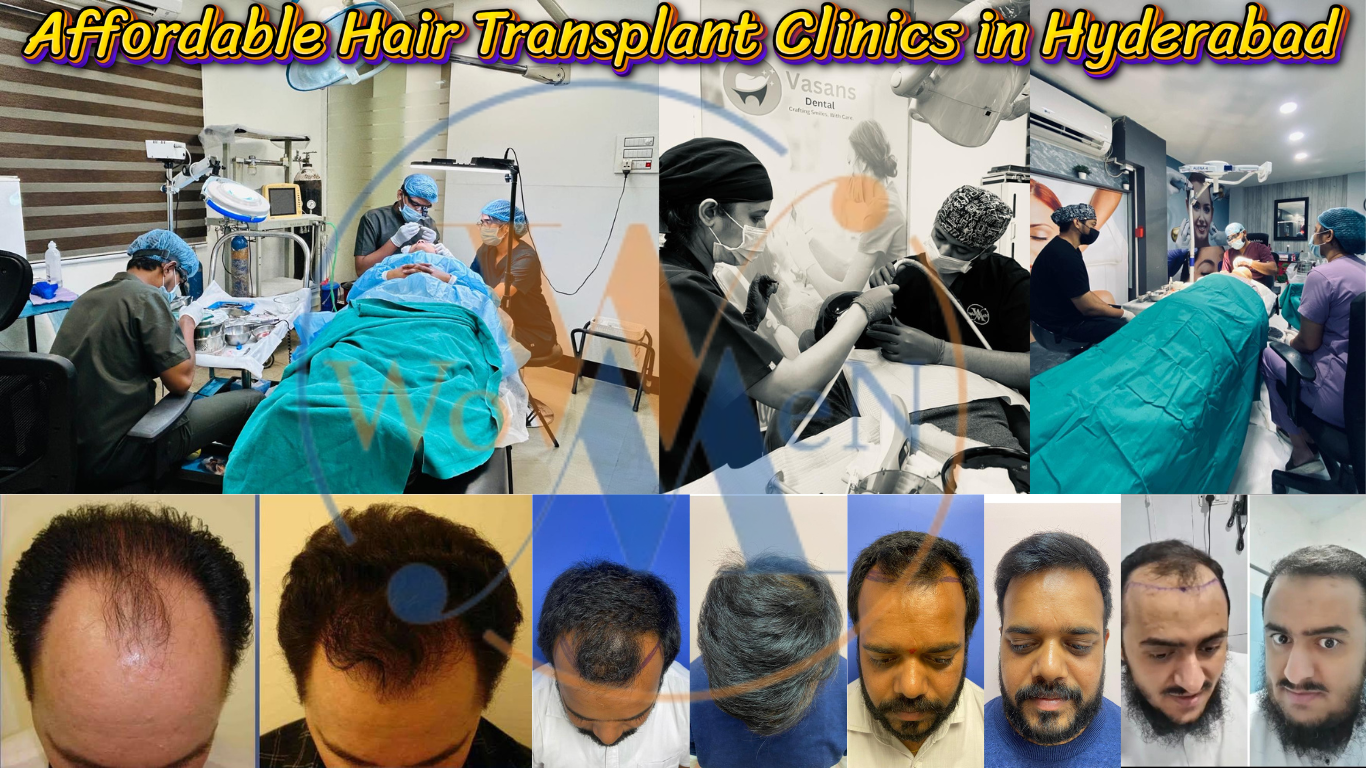 Affordable Hair Transplant Clinics in Hyderabad