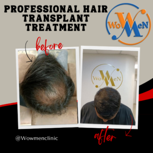 Before and After Hair Treatment By Wowmen Clinic in Hyderabad