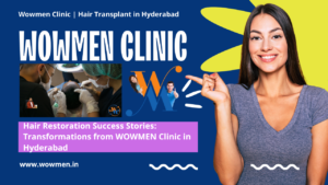 Hair Restoration Success Stories Transformations from WOWMEN Clinic in Hyderabad