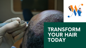 Hair Transplant Centers