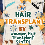 Hair Transplant in Hyderabad