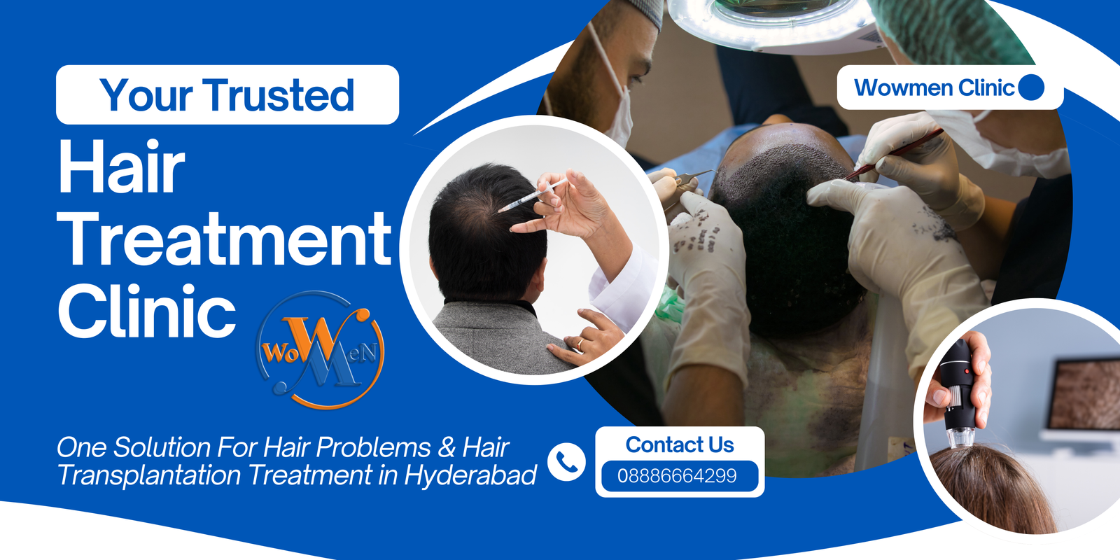 Hair Transplantation Treatment in Hyderabad