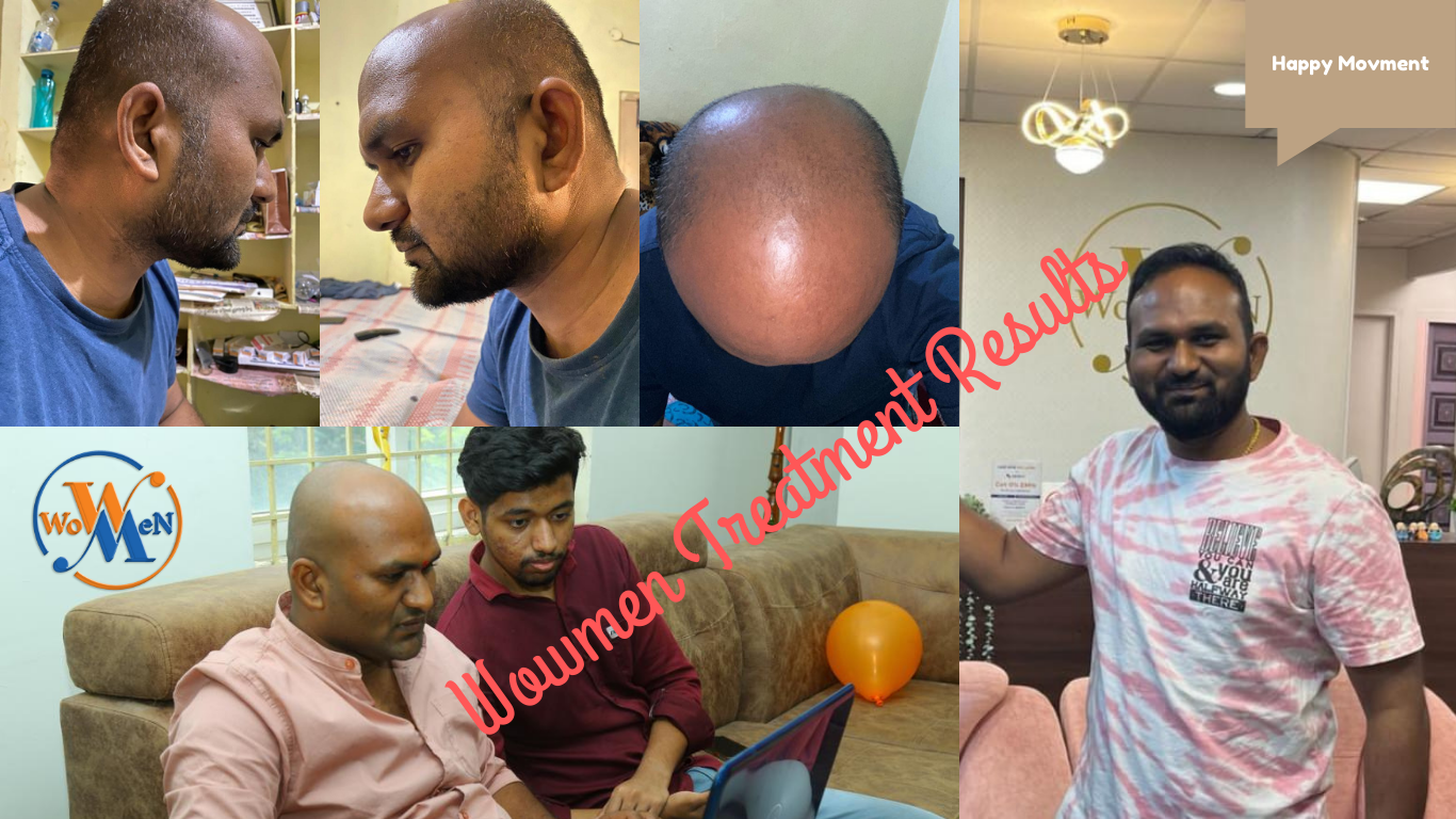 Hair Transplants in Hyderabad