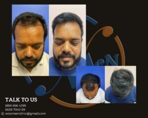 Hair Transplant Centre in Hyderabad