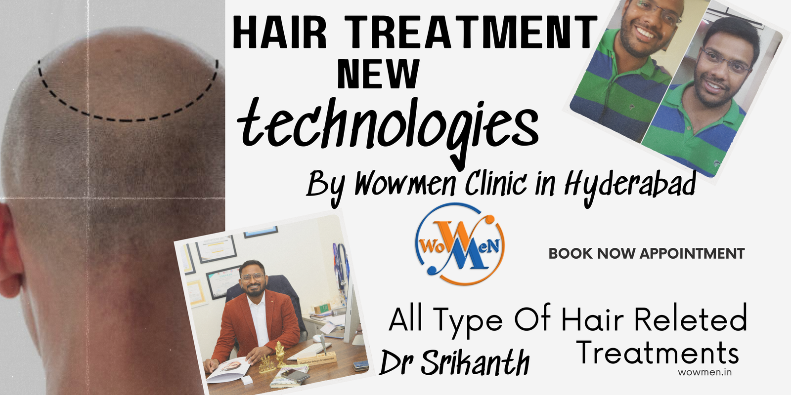 Dr. Srikanth Yadav Puligilla -Hair Transplant Centre