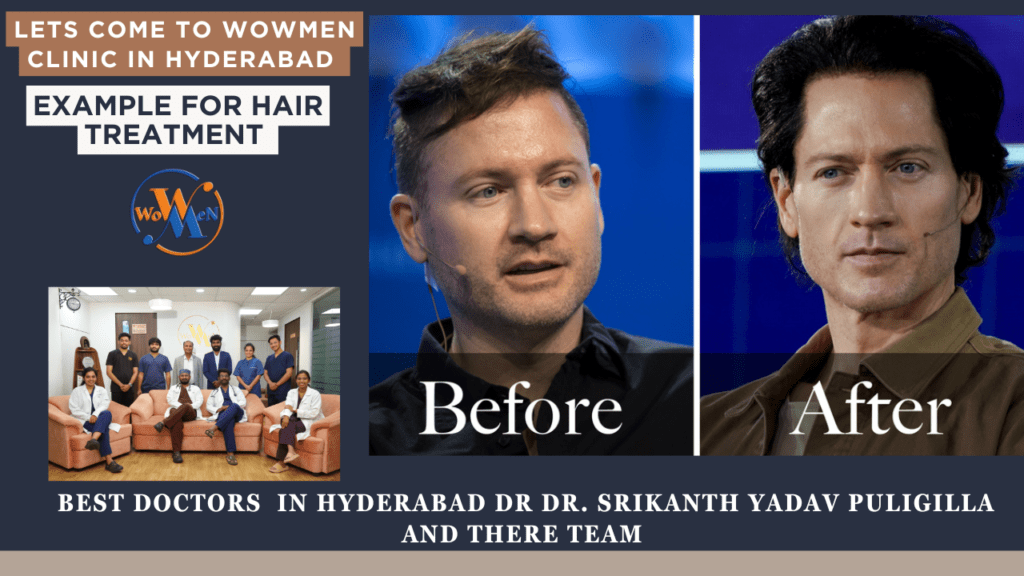 How Bryan Johnson Became a Millionaire and Overcame his Hair Loss: Top Strategies and Solutions That Worked.