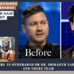 Hair Loss