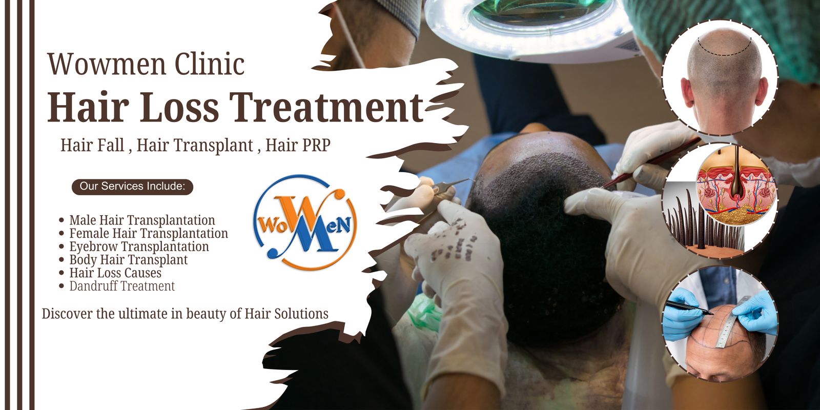 Hair Loss Treatment