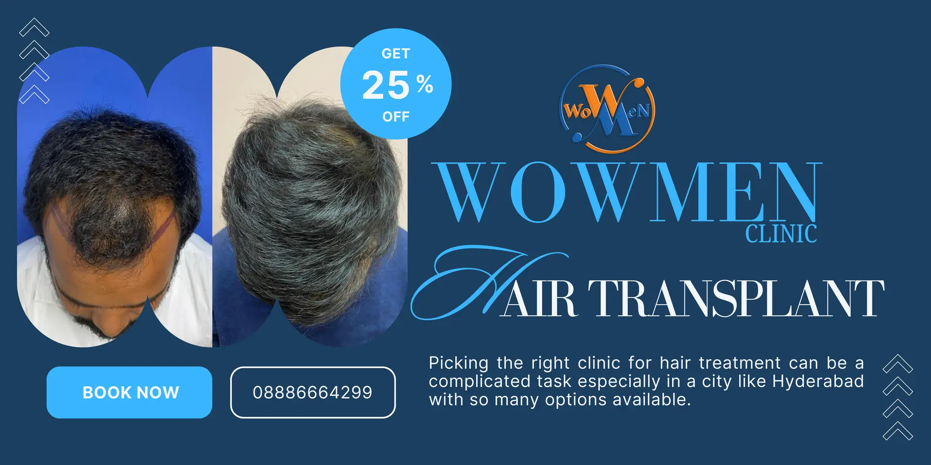 Hair Treatment in Hyderabad