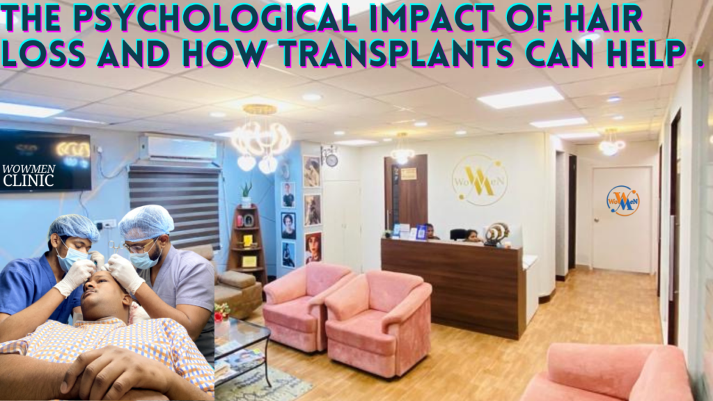 The Psychological Impact of Hair Loss and How Transplants Can Help in 2024